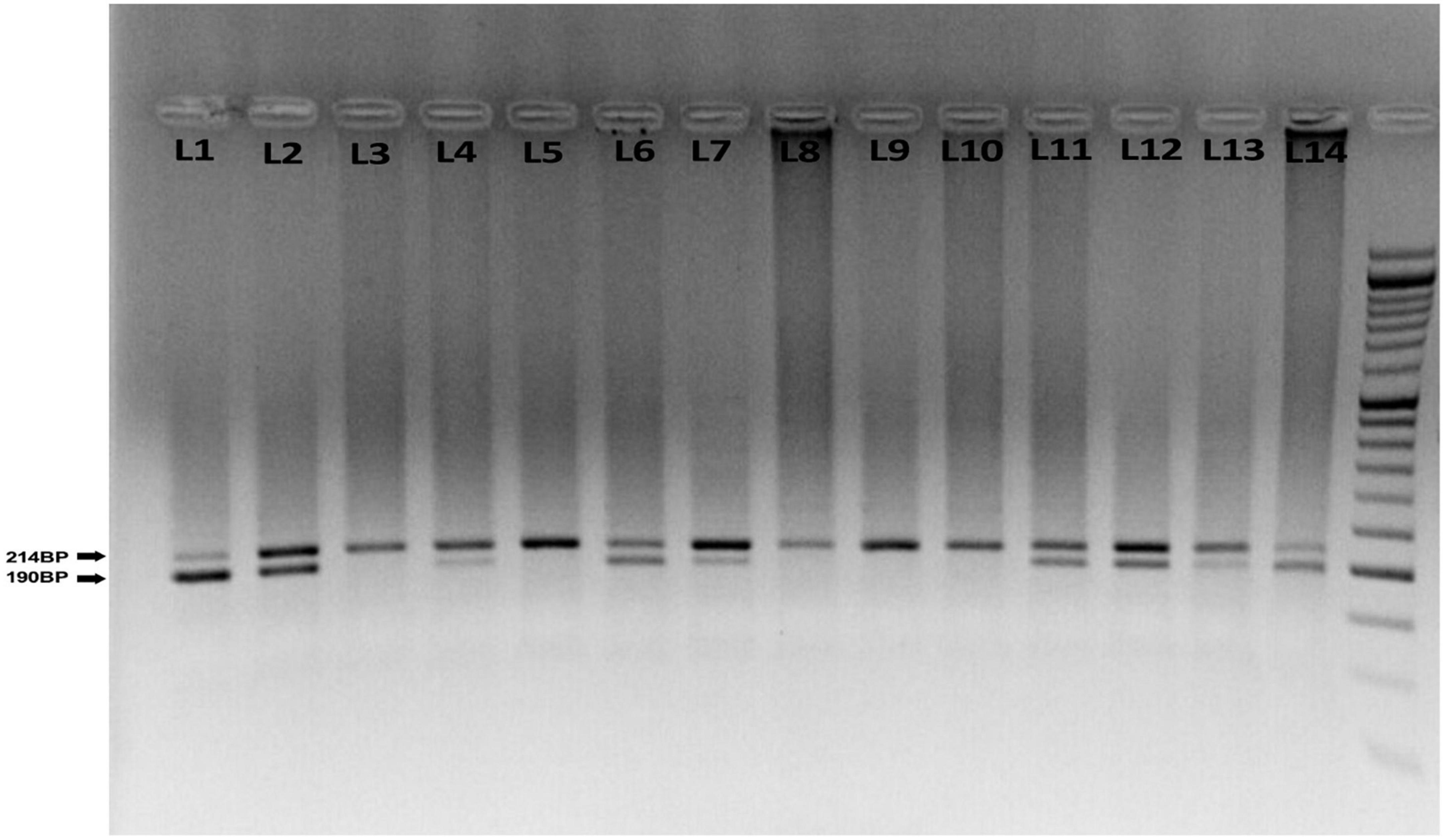 The association of the paraoxonase 1 Q192R polymorphism with coronary artery disease (CAD) and cardiometabolic risk factors in Iranian patients suspected of CAD
